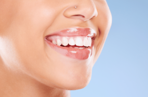 A woman smiling with newly whitened teeth.