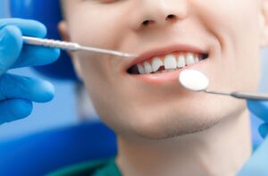 A close-up of a patient's chipped front tooth.