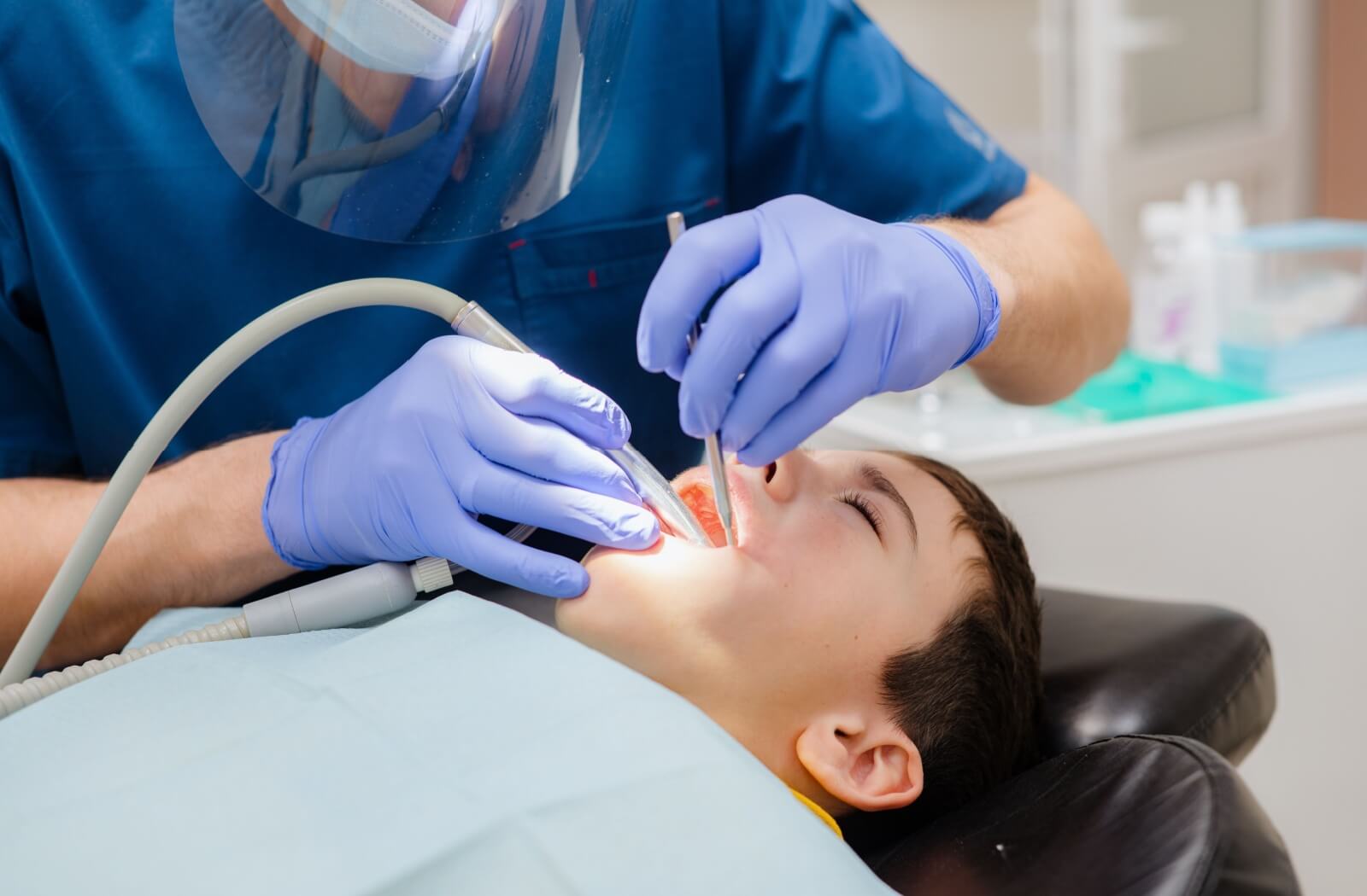 A dentist prepares a cavity in a child's mouth for a filling.