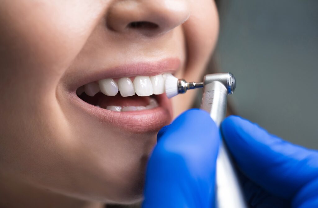 A close-up image of a dental hygienist using a polishing tool to clean their patient's teeth.